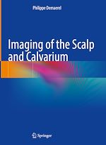 Télécharger le livre :  Imaging of the Scalp and Calvarium