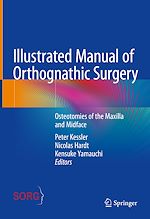 Télécharger le livre :  Illustrated Manual of Orthognathic Surgery