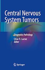 Télécharger le livre :  Central Nervous System Tumors