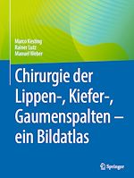 Télécharger le livre :  Chirurgie der Lippen-, Kiefer-, Gaumenspalten – ein Bildatlas