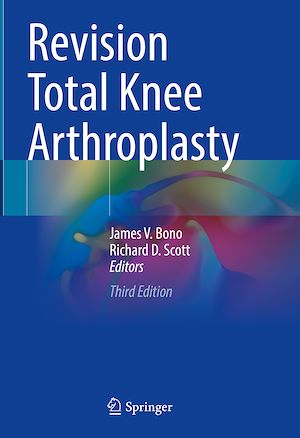 Téléchargez le livre :  Revision Total Knee Arthroplasty
