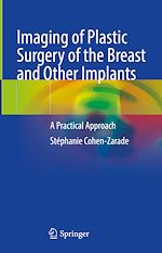 Télécharger le livre :  Imaging of Plastic Surgery of the Breast and Other Implants