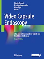 Télécharger le livre :  Video Capsule Endoscopy