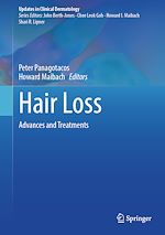 Télécharger le livre :  Hair Loss