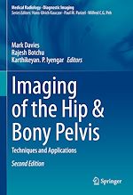 Télécharger le livre :  Imaging of the Hip & Bony Pelvis