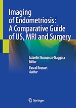 Télécharger le livre :  Imaging of Endometriosis: A Comparative Guide of US, MRI and Surgery