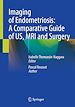 Télécharger le livre :  Imaging of Endometriosis: A Comparative Guide of US, MRI and Surgery