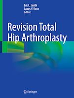 Télécharger le livre :  Revision Total Hip Arthroplasty