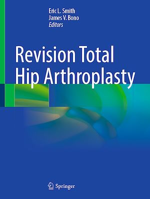 Téléchargez le livre :  Revision Total Hip Arthroplasty