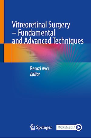 Téléchargez le livre :  Vitreoretinal Surgery – Fundamental and Advanced Techniques