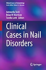 Télécharger le livre :  Clinical Cases in Nail Disorders