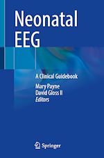 Télécharger le livre :  Neonatal EEG