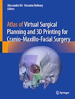 Télécharger le livre :  Atlas of Virtual Surgical Planning and 3D Printing for Cranio-Maxillo-Facial Surgery