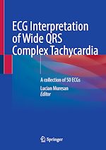 Télécharger le livre :  ECG Interpretation of Wide QRS Complex Tachycardia