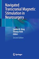 Télécharger le livre :  Navigated Transcranial Magnetic Stimulation in Neurosurgery