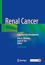 Télécharger le livre :  Renal Cancer