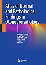 Télécharger le livre :  Atlas of Normal and Pathological Findings in Otoneuroradiology