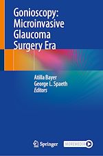 Télécharger le livre :  Gonioscopy: Microinvasive Glaucoma Surgery Era