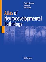 Télécharger le livre :  Atlas of Neurodevelopmental Pathology