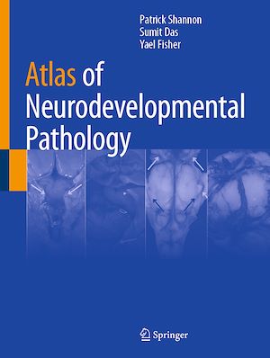 Téléchargez le livre :  Atlas of Neurodevelopmental Pathology