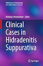 Télécharger le livre :  Clinical Cases in Hidradenitis Suppurativa
