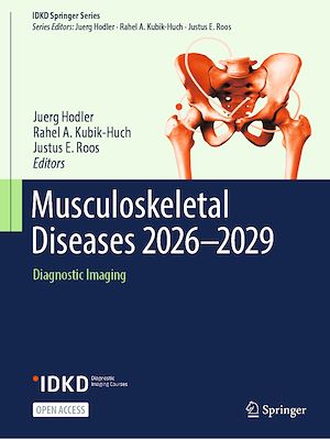 Download the eBook: Musculoskeletal Diseases 2026–2029