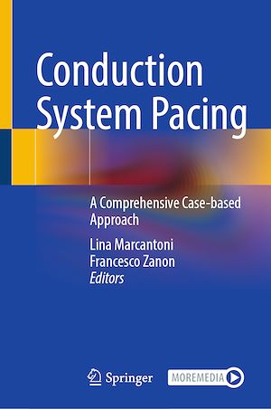Téléchargez le livre :  Conduction System Pacing
