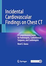 Télécharger le livre :  Incidental Cardiovascular Findings on Chest CT
