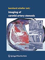 Télécharger le livre :  Imaging of Carotid Artery Stenosis