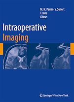 Download this eBook Intraoperative Imaging