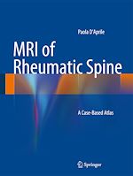 Télécharger le livre :  MRI of Rheumatic Spine