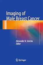 Télécharger le livre :  Imaging of Male Breast Cancer