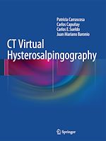 Télécharger le livre :  CT Virtual Hysterosalpingography