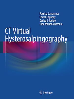 Téléchargez le livre :  CT Virtual Hysterosalpingography