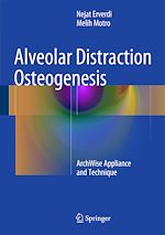 Télécharger le livre :  Alveolar Distraction Osteogenesis