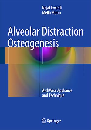 Téléchargez le livre :  Alveolar Distraction Osteogenesis