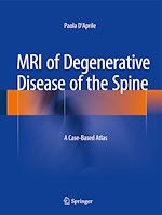 Télécharger le livre :  MRI of Degenerative Disease of the Spine