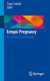 Téléchargez le livre :  Ectopic Pregnancy