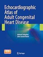 Télécharger le livre :  Echocardiographic Atlas of Adult Congenital Heart Disease