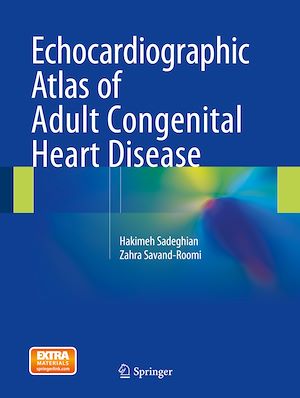 Téléchargez le livre :  Echocardiographic Atlas of Adult Congenital Heart Disease