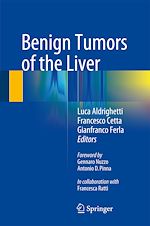 Télécharger le livre :  Benign Tumors of the Liver