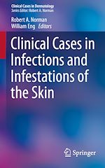 Télécharger le livre :  Clinical Cases in Infections and Infestations of the Skin