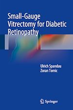 Télécharger le livre :  Small-Gauge Vitrectomy for Diabetic Retinopathy