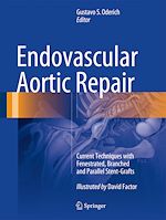 Télécharger le livre :  Endovascular Aortic Repair