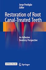 Télécharger le livre :  Restoration of Root Canal-Treated Teeth