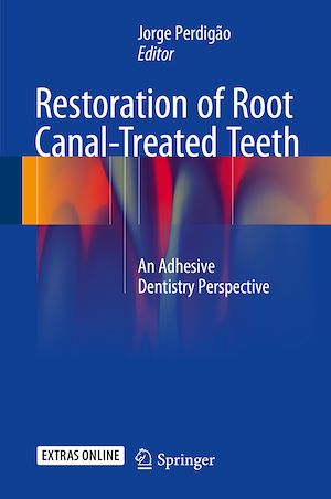 Téléchargez le livre :  Restoration of Root Canal-Treated Teeth