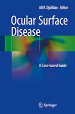 Télécharger le livre :  Ocular Surface Disease