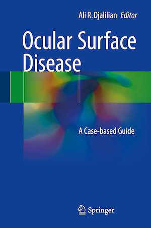 Téléchargez le livre :  Ocular Surface Disease