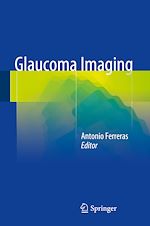 Télécharger le livre :  Glaucoma Imaging