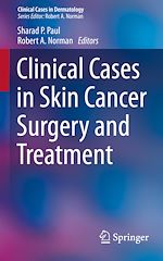 Télécharger le livre :  Clinical Cases in Skin Cancer Surgery and Treatment
